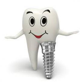 سوالات متداول در مورد ایمپلنت دندان ( بخش اول)